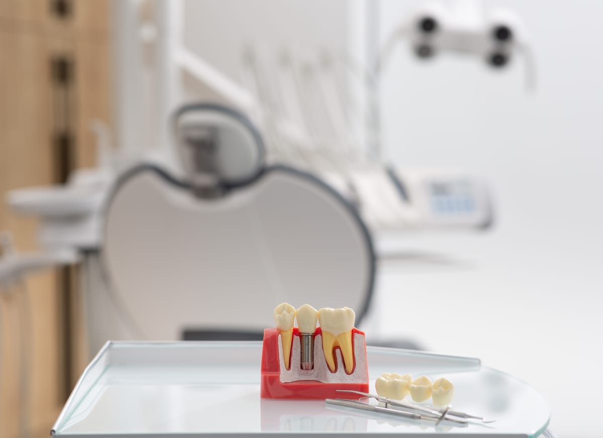 Dental Implants in Harwood Heights